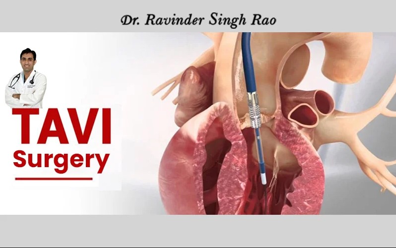 Advanced TAVI Surgery Doctor in Jaipur – Dr. Ravinder Singh Rao