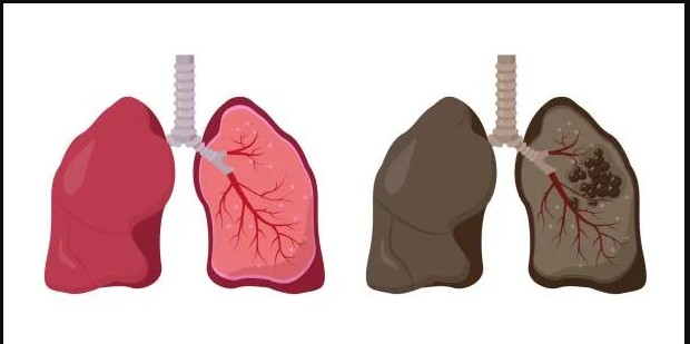 Advanced Bronchoscopy Center in Jaipur City, Rajasthan – Asthma Bhawan